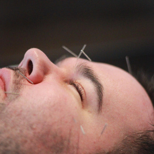 TCM Practitioner for Skin Problems Bayside: A Holistic Path to Radiance