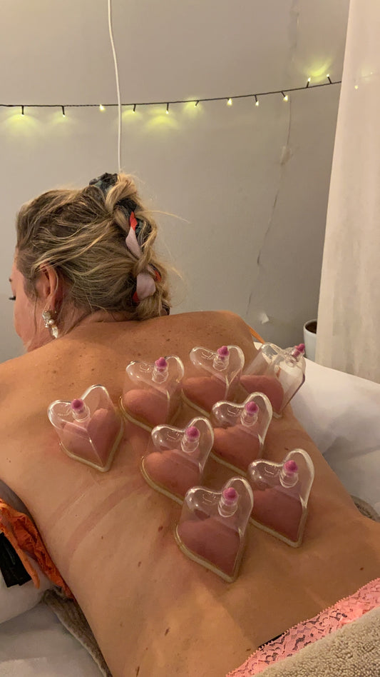 Cupping for Back Pain in Oakleigh: The Logic-Based Rebel’s Guide