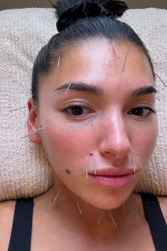 Look Less Tired Without Botox: The St Kilda Guide to Natural Rejuvenation