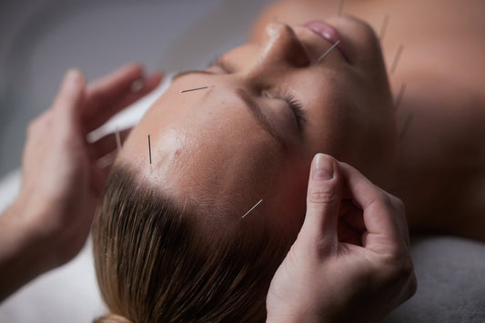 Skin Focused Acupuncture Melbourne: A Logic-Based Guide to Your Natural Glow