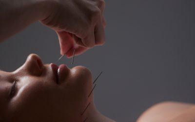 Cosmetic Acupuncture in Melbourne, Australia: Unveiling Zhong Centre’s Efficacy and Safety